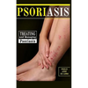 Psoriasis: Treating and Managing Psoriasis - Paperback