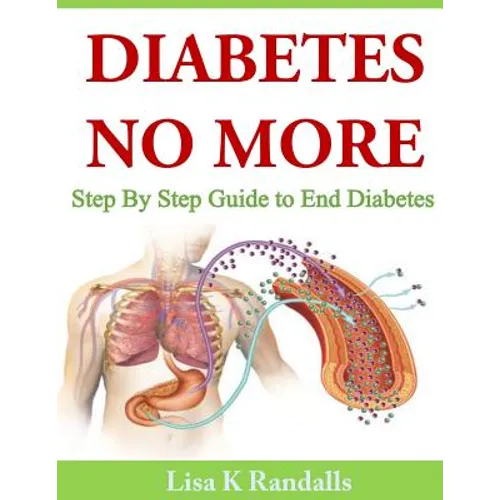 Diabetes No More: Step By Step Guide to End Diabetes - Paperback