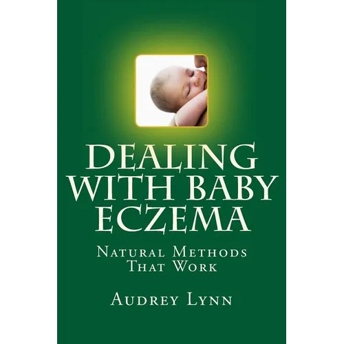 Dealing With Baby Eczema: Natural Methods That Work - Paperback