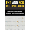 EKG and ECG Interpretation: Learn EKG Interpretation, Rhythms, and Arrhythmia Fast! - Paperback