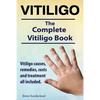 Vitiligo. Vitiligo causes, remedies, costs and treatment all included. The complete Vitiligo Book. - Paperback