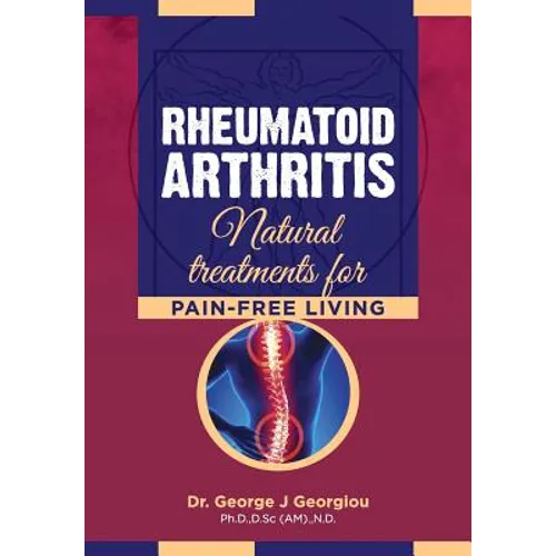 Rheumatoid Arthritis: Natural Treatments for Pain-Free Living - Paperback