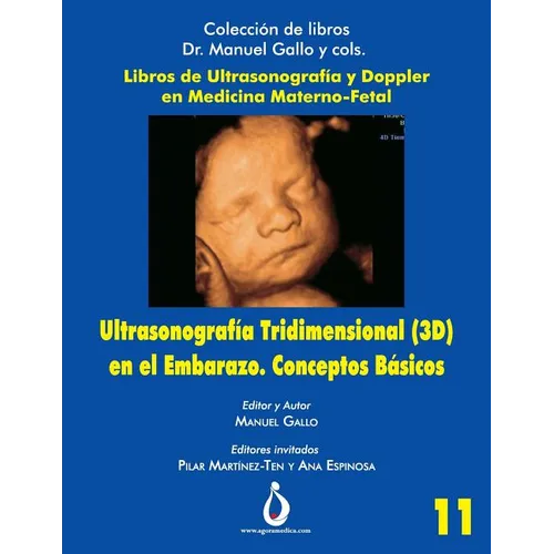 Ultrasonografia Tridimensional en el Embarazo (3D). Conceptos Básicos - Paperback