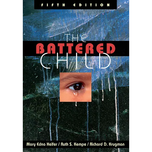 The Battered Child - Paperback