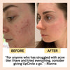 Face Toner with Hyaluronic Acid