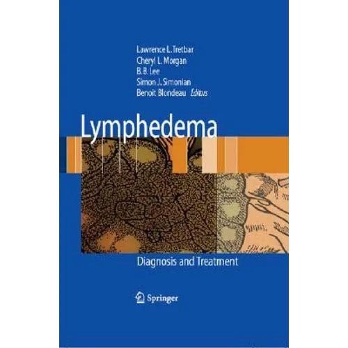 Lymphedema: Diagnosis and Treatment - Hardcover