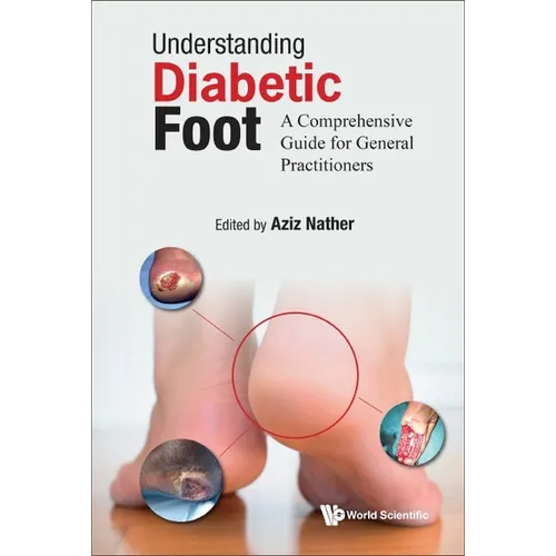Understanding Diabetic Foot - Hardcover