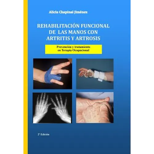 Rehabilitación funcional de las manos con artritis y artrosis: Prevención y tratamiento - Paperback