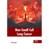 Non-Small Cell Lung Cancer - Hardcover