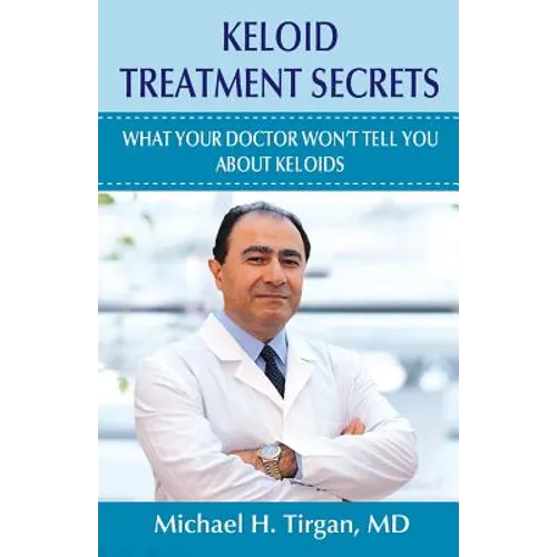 Keloid Treatment Secrets: What Your Doctor Wont Tell You. - Paperback
