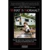 What Is Normal? - Paperback