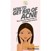 How To Get Rid of Acne: Your Step By Step Guide To Getting Rid of Acne - Hardcover