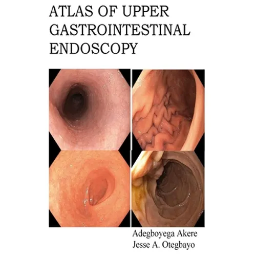 Atlas of Upper Gastrointestinal Endoscopy - Paperback