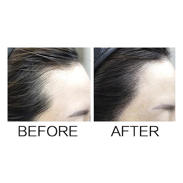 Neat Symmetry Hairline With Mirror Puff Fibers