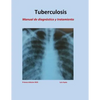 Tratamiento de Tuberculosis: Manual de diagnóstico y tratamiento - Paperback