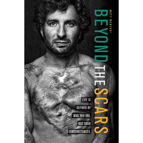 Beyond the Scars: Life Is Defined by Who You Are, Not Your Circumstances - Paperback
