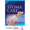 Stoma Care - Paperback