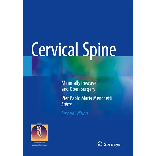 Cervical Spine: Minimally Invasive and Open Surgery - Paperback