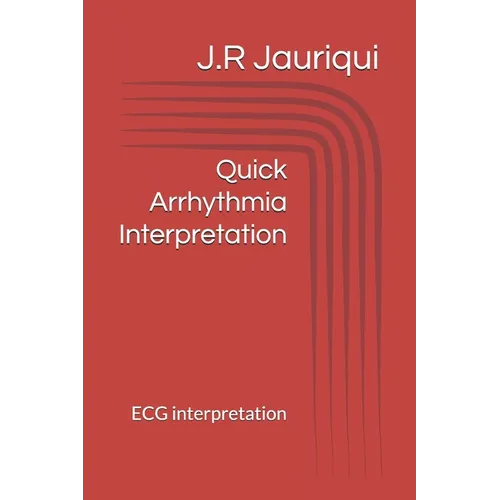 Quick Arrhythmia Interpretation: ECG interpretation - Paperback