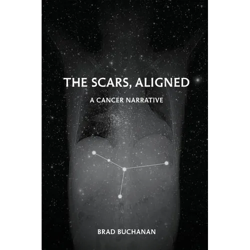 The Scars, Aligned - Paperback