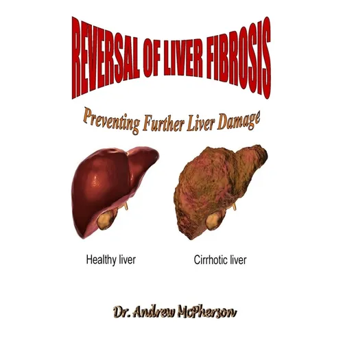 Reversal of Liver Fibrosis: Preventing Further Liver Damage - Paperback