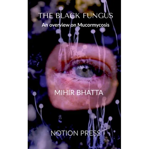 THE BLACK FUNGUS An overview on Mucormycosis - Paperback