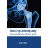 Total Hip Arthroplasty: A Comprehensive Clinical Guide - Hardcover