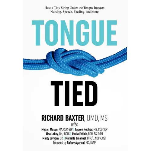 Tongue-Tied: How a Tiny String Under the Tongue Impacts Nursing, Speech, Feeding, and More - Hardcover