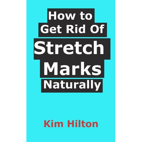How to Get Rid Of Stretch Marks Naturally - Paperback