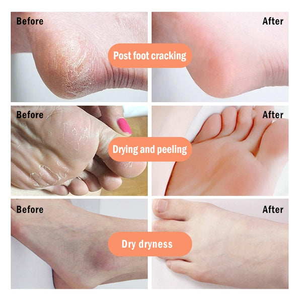Dead Skin Remover Banana Oil Cream Repair Heel Skin Crack Balm Winter Anti-Drying Beauty Feet Care Prodcut TSLM2